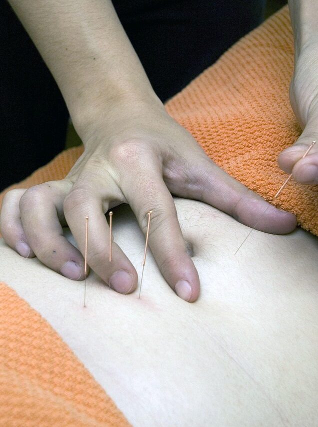 Dans certaines universités, des diplômes de médecines alternatives qui 